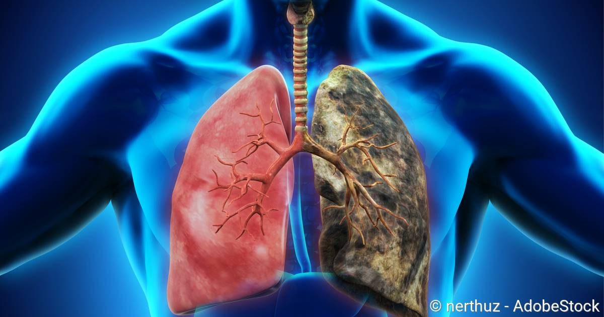 Nurturing Your Lung Resilience