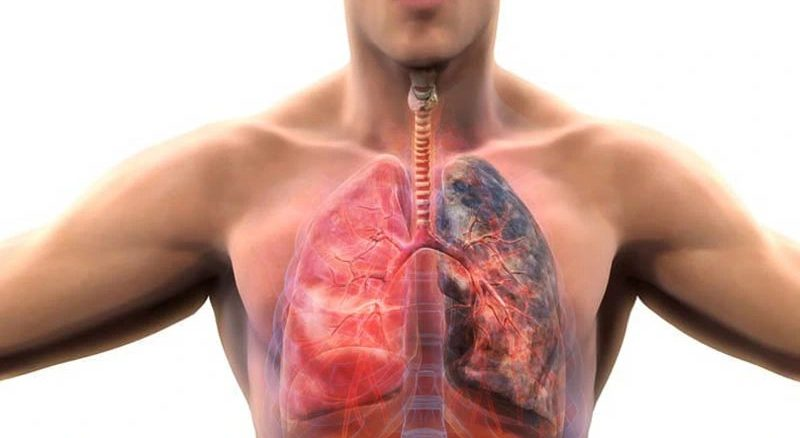 Nurturing Your Lung Resilience