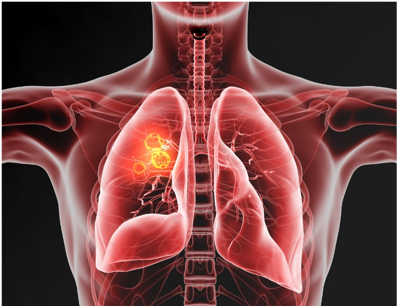 Nurturing Your Lung Resilience