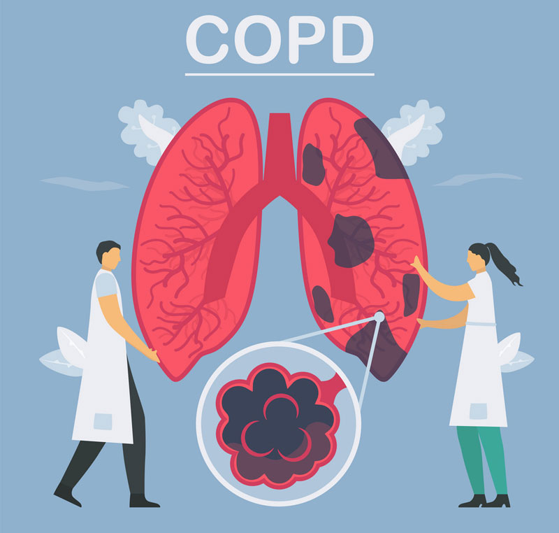Nurturing Your Lung Resilience